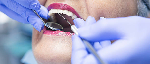 Best Emergency Denture Repair in Rshfield Hills, MA